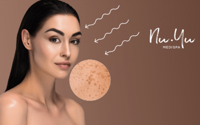 Sun Damage and Pigmentation in Qatar: What Happens to Your Skin in June and How to Fix It